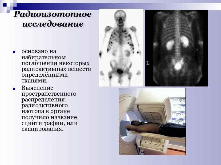 Радиоизотопное исследование основано на избирательном поглощении некоторых радиоактивных веществ определёнными