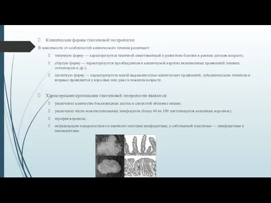 Клинические формы глютеновой энтеропатии В зависимости от особенностей клинического течения