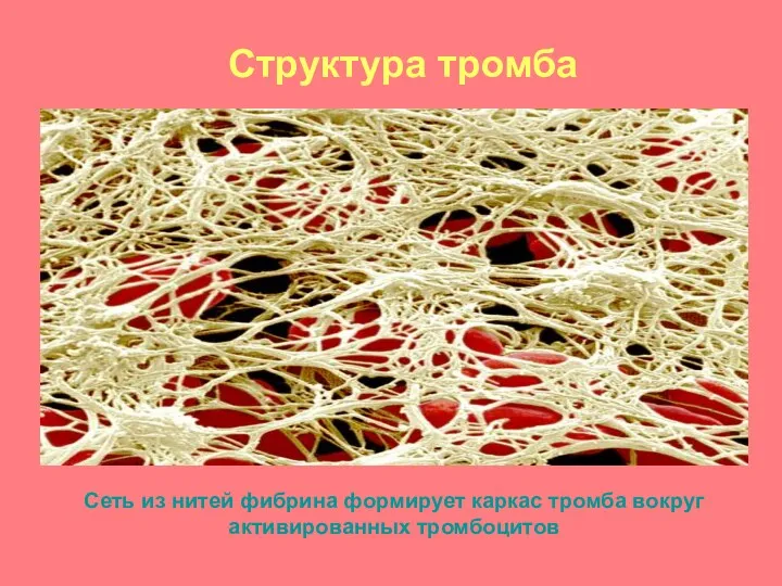 Структура тромба Сеть из нитей фибрина формирует каркас тромба вокруг активированных тромбоцитов