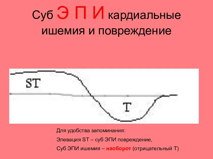 Суб Э П И кардиальные ишемия и повреждение Для удобства