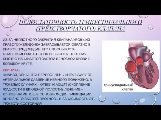 НЕДОСТАТОЧНОСТЬ ТРИКУСПИДАЛЬНОГО (ТРЁХСТВОРЧАТОГО) КЛАПАНА ИЗ-ЗА НЕПЛОТНОГО ЗАКРЫТИЯ КЛАПАНА,КРОВЬ ИЗ ПРАВОГО