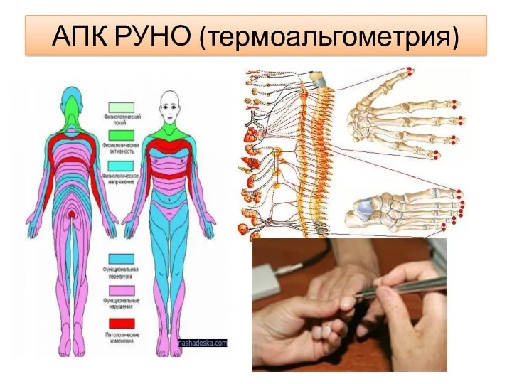 АПК РУНО (термоальгометрия)