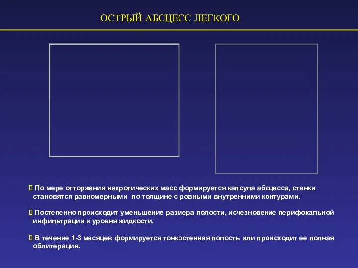 ОСТРЫЙ АБСЦЕСС ЛЕГКОГО По мере отторжения некротических масс формируется капсула