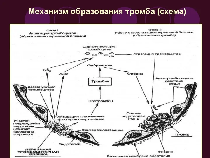 Механизм образования тромба (схема)