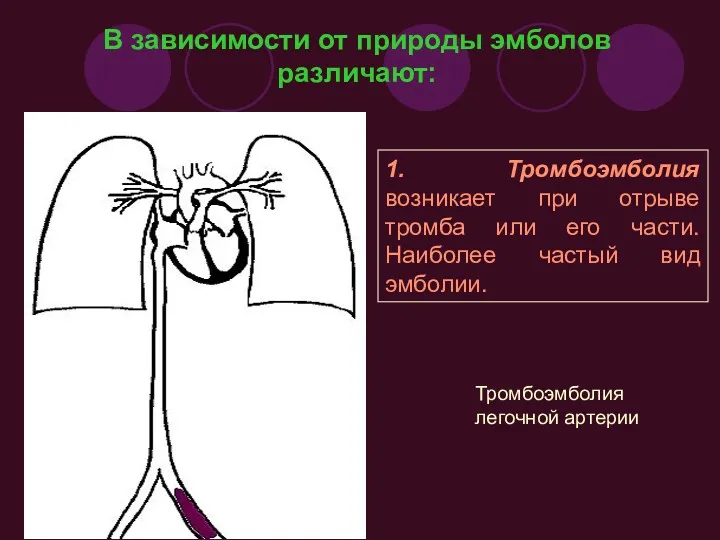 В зависимости от природы эмболов различают: 1. Тромбоэмболия возникает при