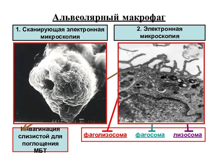 Альвеолярный макрофаг 2. Электронная микроскопия 1. Сканирующая электронная микроскопия фаголизосома