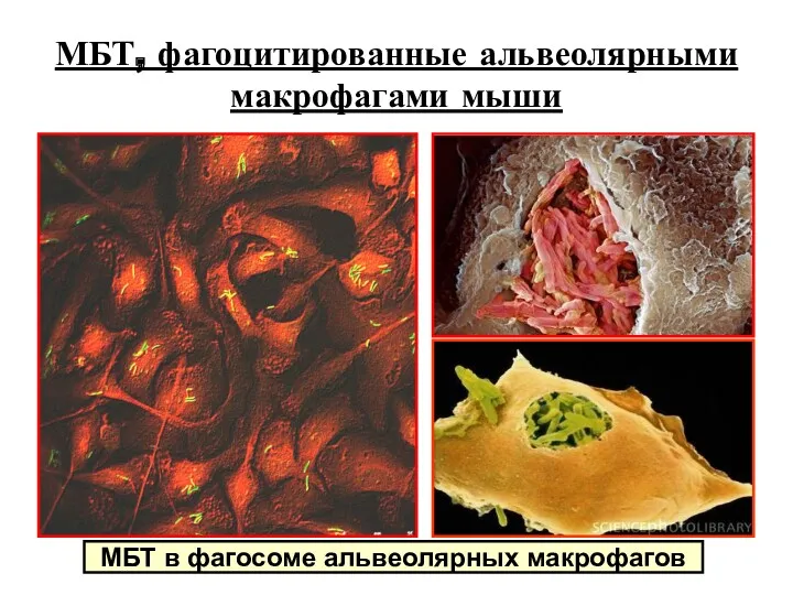 МБТ, фагоцитированные альвеолярными макрофагами мыши МБТ в фагосоме альвеолярных макрофагов