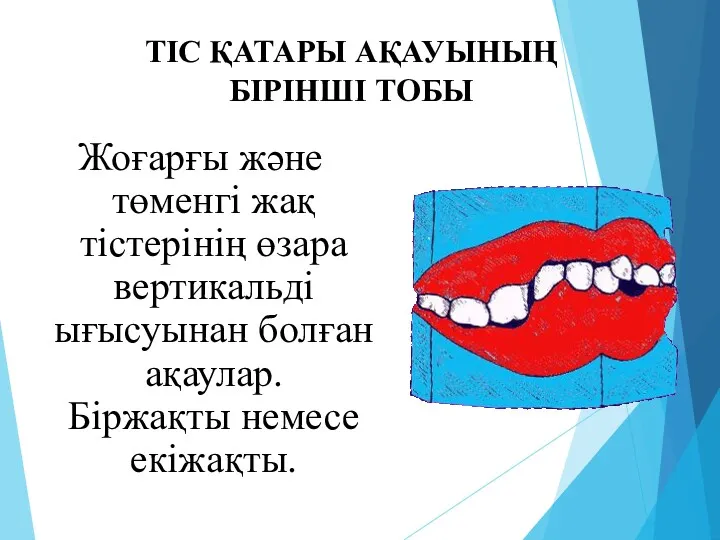 ТІС ҚАТАРЫ АҚАУЫНЫҢ БІРІНШІ ТОБЫ Жоғарғы және төменгі жақ тістерінің өзара вертикальді ығысуынан