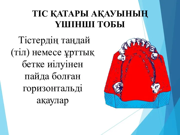 ТІС ҚАТАРЫ АҚАУЫНЫҢ ҮШІНШІ ТОБЫ Тістердің таңдай(тіл) немесе ұрттық бетке иілуінен пайда болған горизонтальді ақаулар