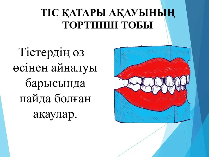 ТІС ҚАТАРЫ АҚАУЫНЫҢ ТӨРТІНШІ ТОБЫ Тістердің өз өсінен айналуы барысында пайда болған ақаулар.