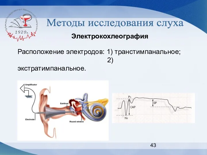 Методы исследования слуха Электрокохлеография Расположение электродов: 1) транстимпанальное; 2) экстратимпанальное.
