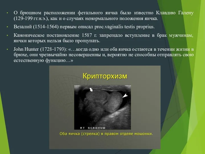 О брюшном расположении фетального яичка было известно Клавдию Галену (129-199
