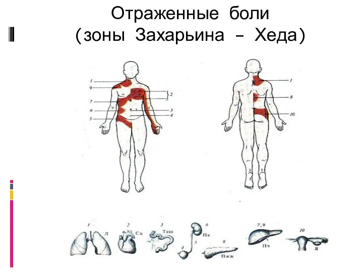 Отраженные боли (зоны Захарьина – Хеда)