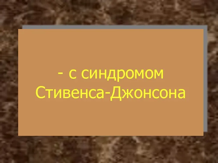 - с синдромом Стивенса-Джонсона