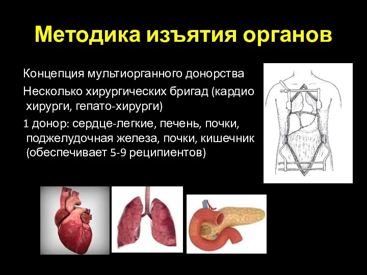 Методика изъятия органов Концепция мультиорганного донорства Несколько хирургических бригад (кардио