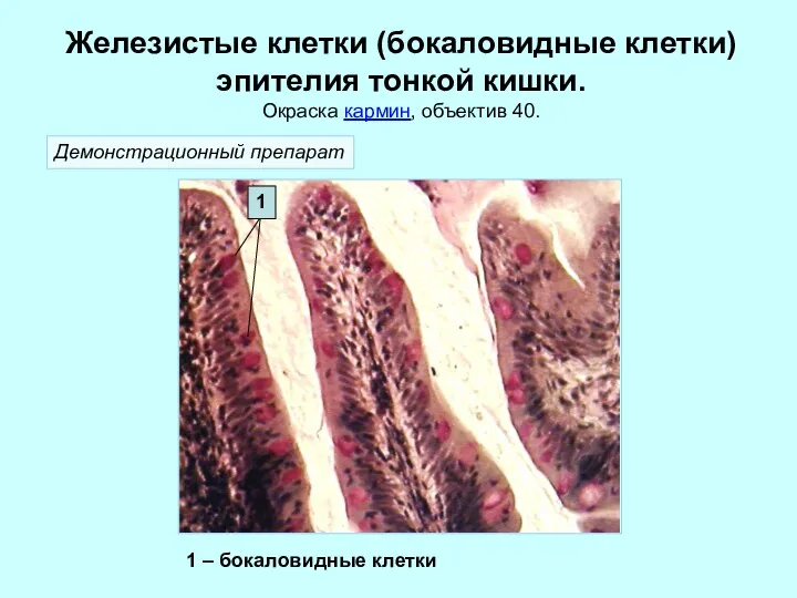 Железистые клетки (бокаловидные клетки) эпителия тонкой кишки. Окраска кармин, объектив