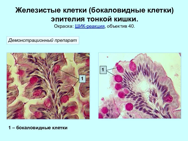 Железистые клетки (бокаловидные клетки) эпителия тонкой кишки. Окраска: ШИК-реакция, объектив