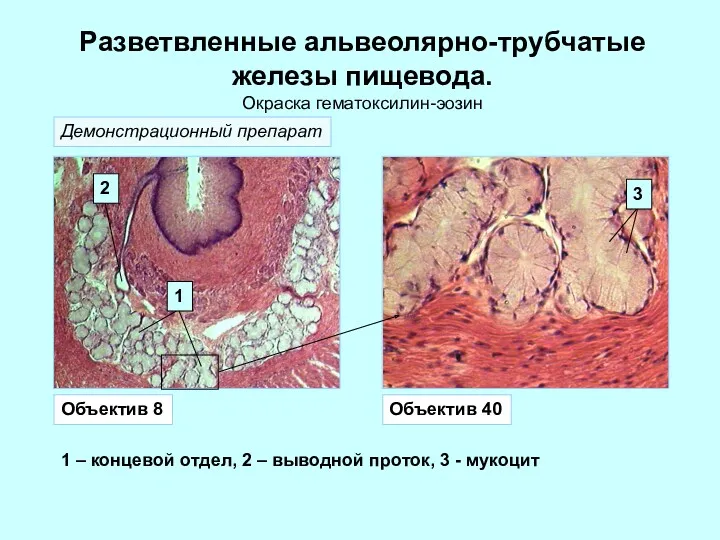 Разветвленные альвеолярно-трубчатые железы пищевода. Окраска гематоксилин-эозин Объектив 8 Объектив 40
