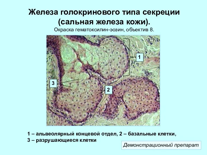 Железа голокринового типа секреции (сальная железа кожи). Окраска гематоксилин-эозин, объектив