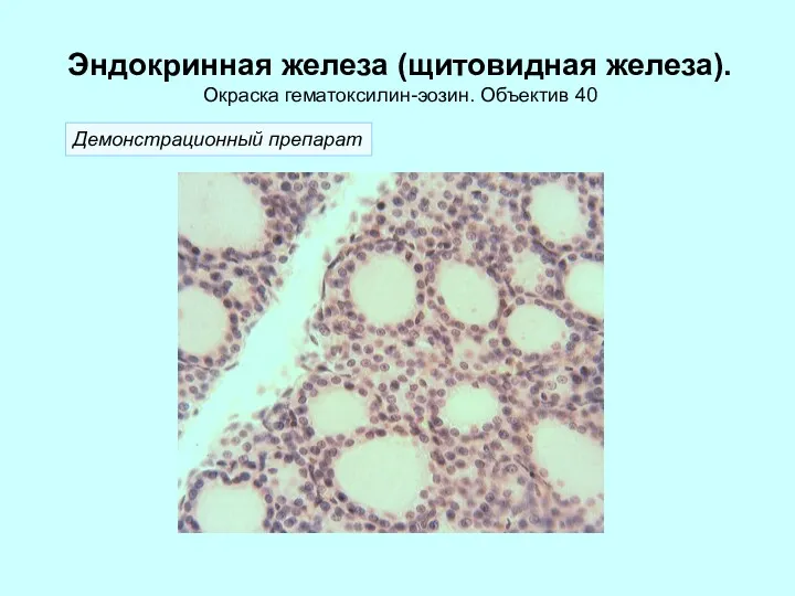 Эндокринная железа (щитовидная железа). Окраска гематоксилин-эозин. Объектив 40 Демонстрационный препарат