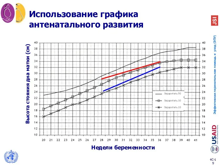 Недели беременности Высота стояния дна матки (см) Использование графика антенатального