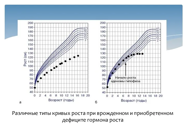 Различные типы кривых роста при врожденном и приобретенном дефиците гормона роста