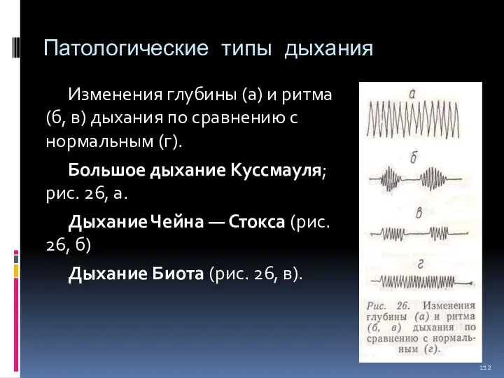 Патологические типы дыхания Изменения глубины (а) и ритма (б, в)