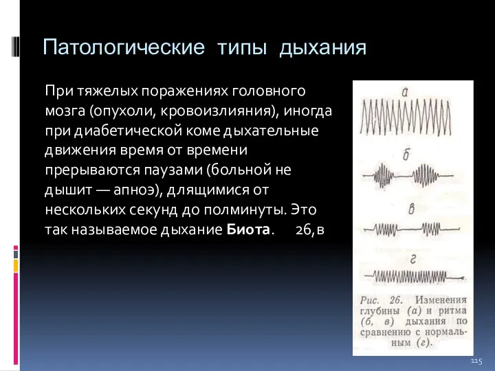 Патологические типы дыхания При тяжелых поражениях головного мозга (опухоли, кровоизлияния),