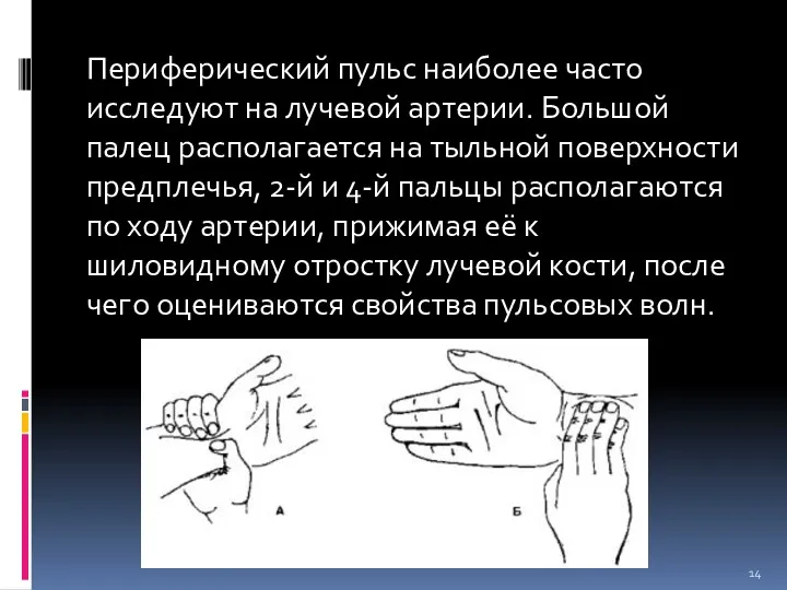 Периферический пульс наиболее часто исследуют на лучевой артерии. Большой палец