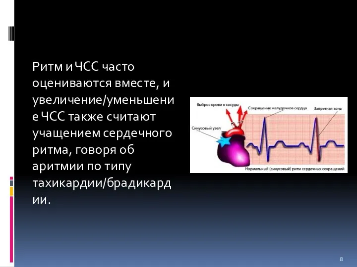 Ритм и ЧСС часто оцениваются вместе, и увеличение/уменьшение ЧСС также