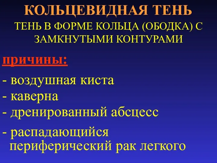 КОЛЬЦЕВИДНАЯ ТЕНЬ ТЕНЬ В ФОРМЕ КОЛЬЦА (ОБОДКА) С ЗАМКНУТЫМИ КОНТУРАМИ