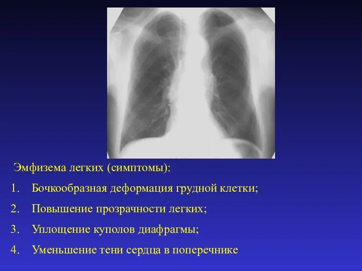 Эмфизема легких (симптомы): Бочкообразная деформация грудной клетки; Повышение прозрачности легких;