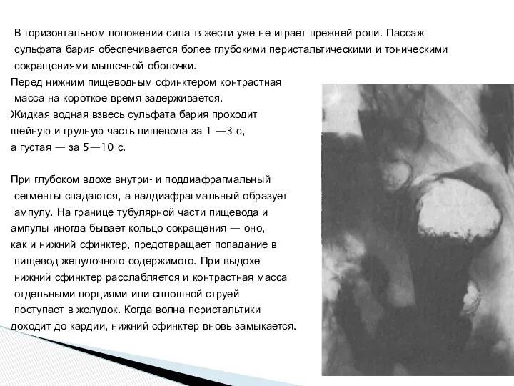 В горизонтальном положении сила тяжести уже не играет прежней роли.