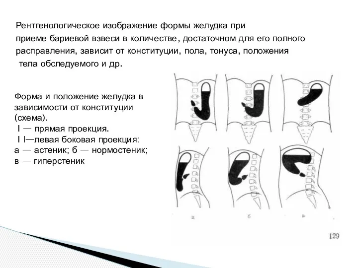 Рентгенологическое изображение формы желудка при приеме бариевой взвеси в количестве,