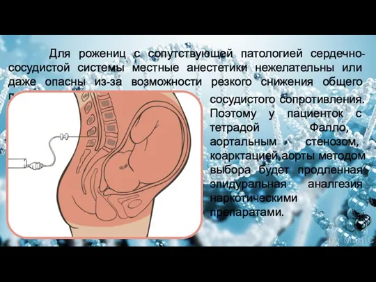 Для рожениц с сопутствующей патологией сердечно-сосудистой системы местные анестетики нежелательны