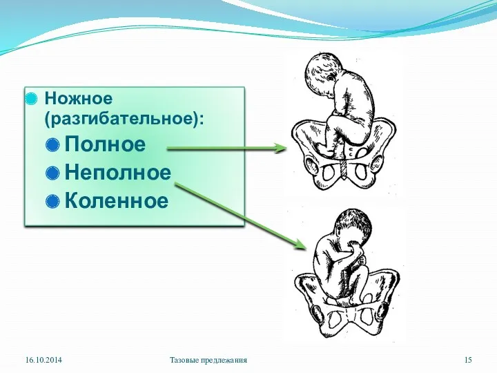 Ножное (разгибательное): Полное Неполное Коленное 16.10.2014 Тазовые предлежания