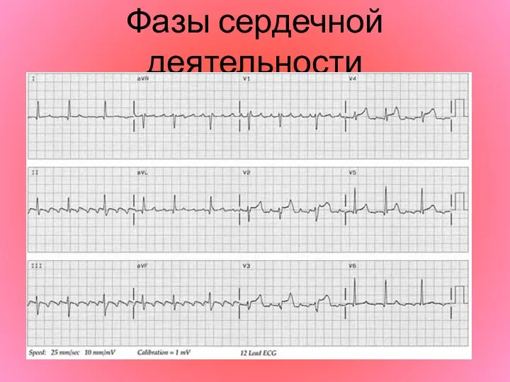 Фазы сердечной деятельности