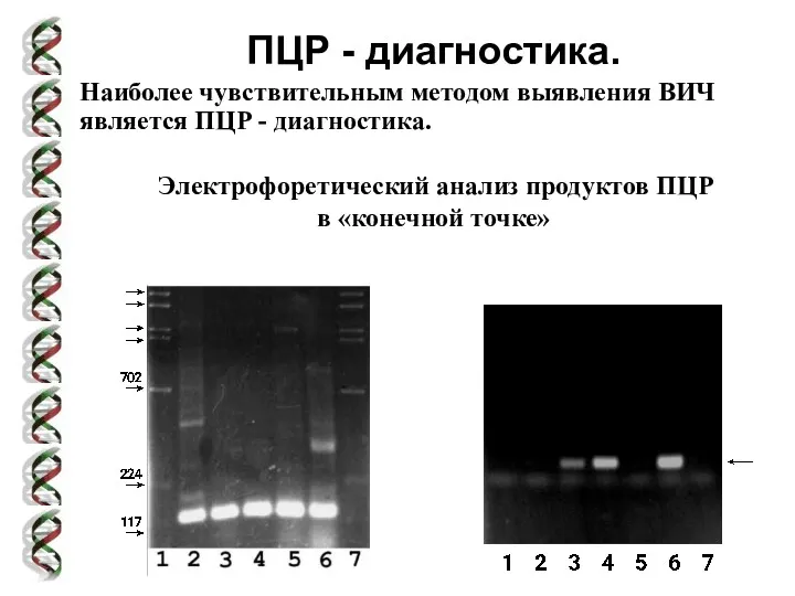 ПЦР - диагностика. Наиболее чувствительным методом выявления ВИЧ является ПЦР