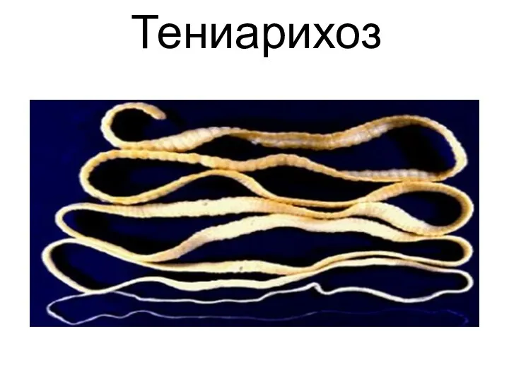 Тениарихоз