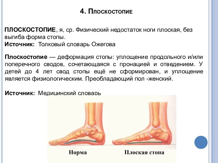 4. Плоскостопие ПЛОСКОСТОПИЕ, я, ср. Физический недостаток ноги плоская, без