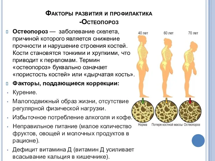 Факторы развития и профилактика -Остеопороз Остеопороз — заболевание скелета, причиной