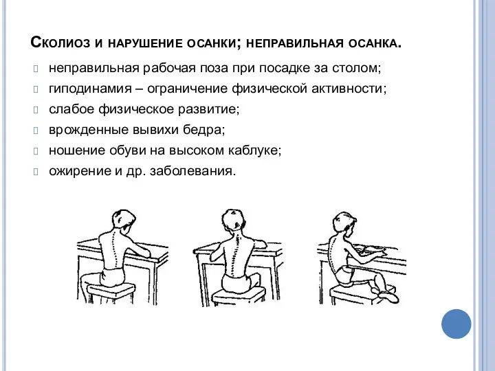 Сколиоз и нарушение осанки; неправильная осанка. неправильная рабочая поза при