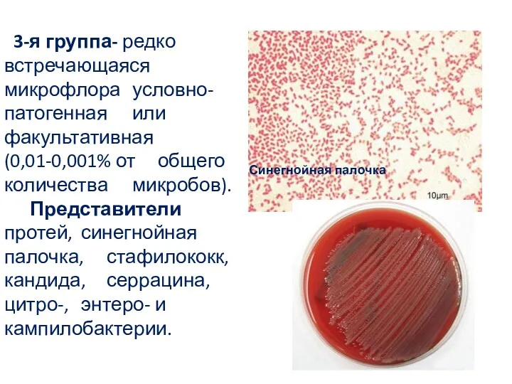 3-я группа- редко встречающаяся микрофлора условно-патогенная или факультативная (0,01-0,001% от общего количества микробов).