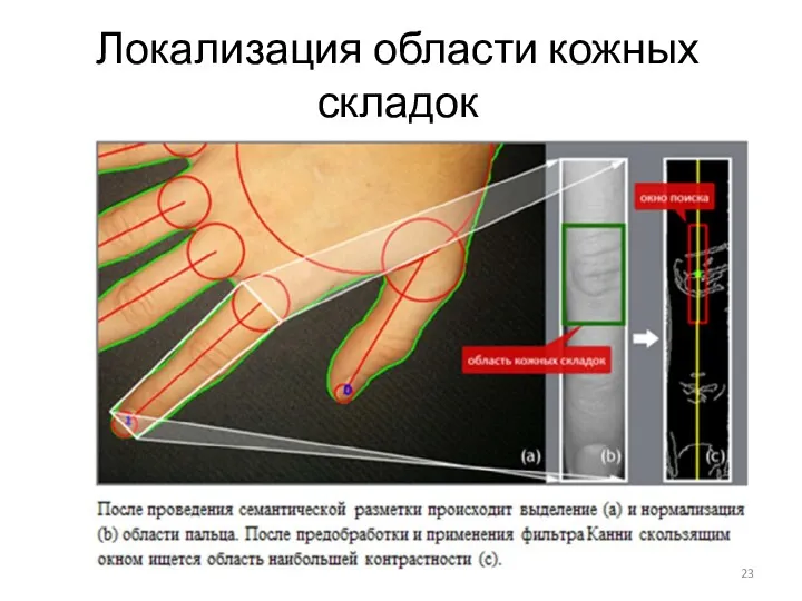 Локализация области кожных складок