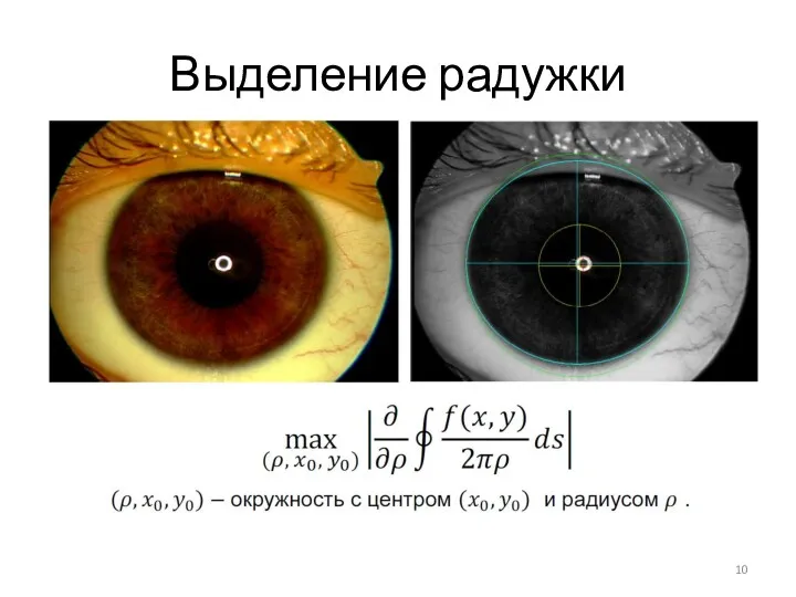 Выделение радужки