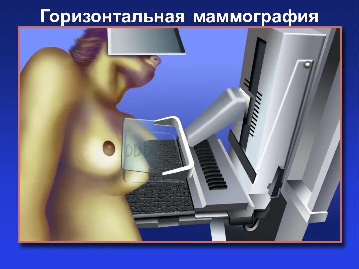 Горизонтальная маммография