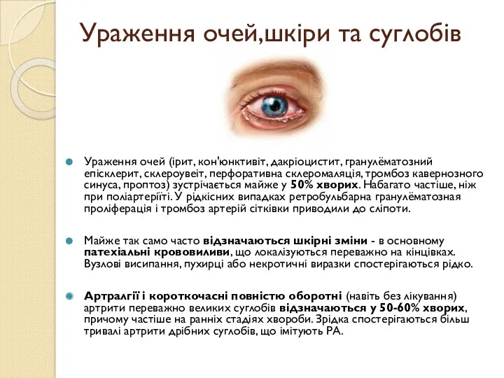 Ураження очей,шкіри та суглобів Ураження очей (ірит, кон'юнктивіт, дакріоцистит, гранулёматозний