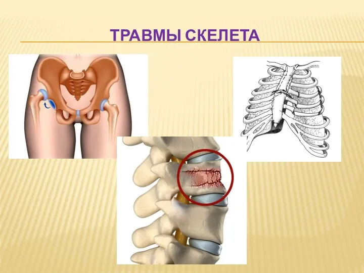 ТРАВМЫ СКЕЛЕТА