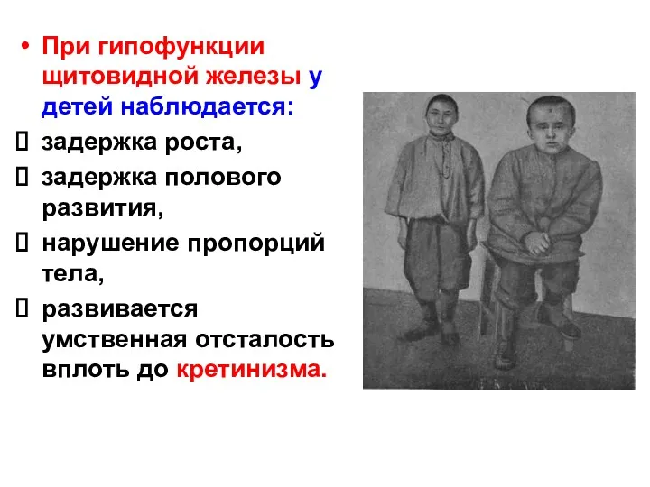 При гипофункции щитовидной железы у детей наблюдается: задержка роста, задержка