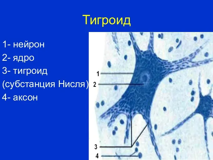 Тигроид 1- нейрон 2- ядро 3- тигроид (субстанция Нисля) 4- аксон